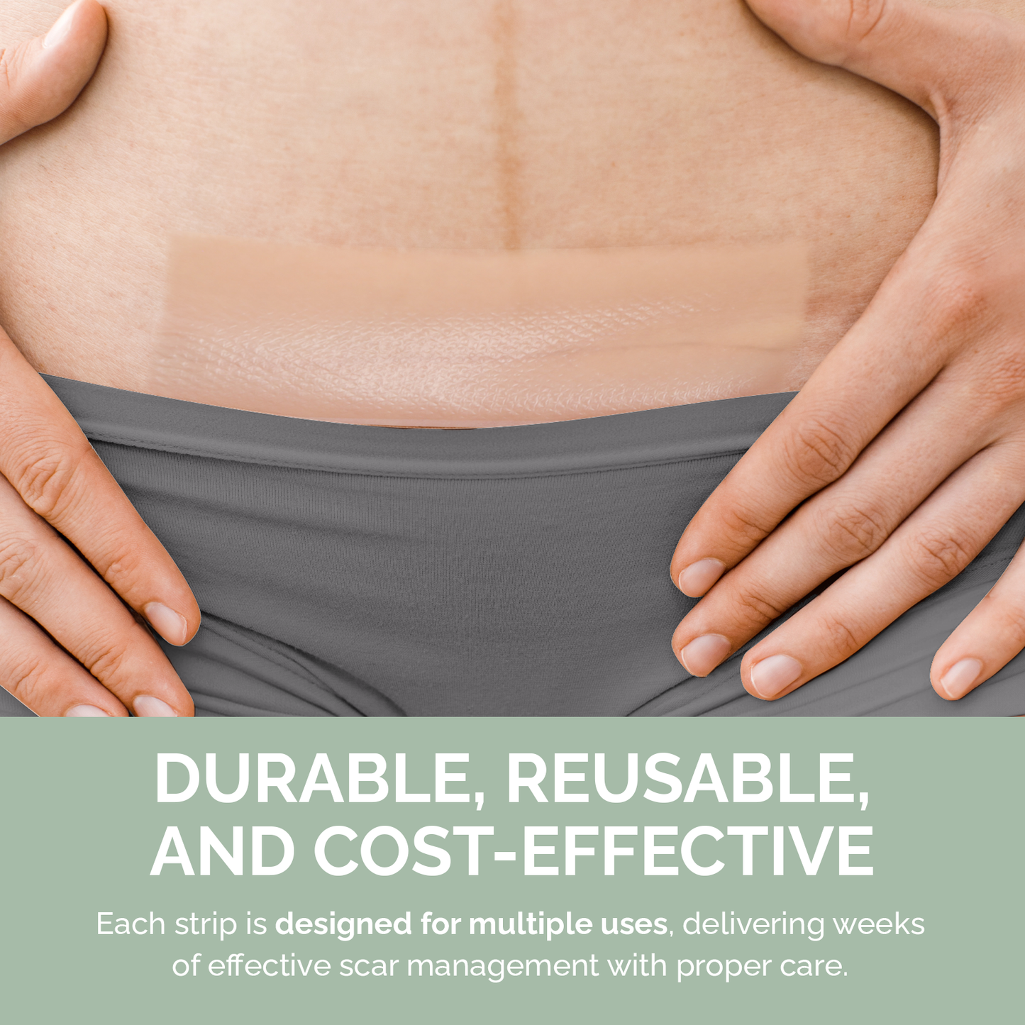 Silicone Scar Strips