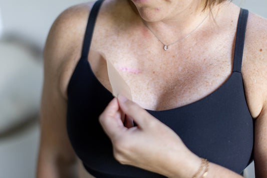 Silicone Scar Strips